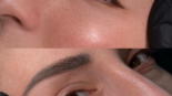 How Long Do Eyes Stay Swollen After Permanent Eyeliner